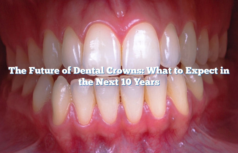 The Future of Dental Crowns: What to Expect in the Next 10 Years