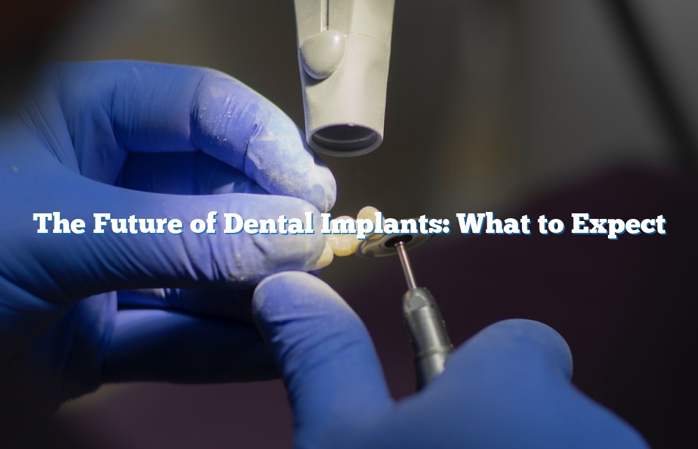 The Future of Dental Implants: What to Expect