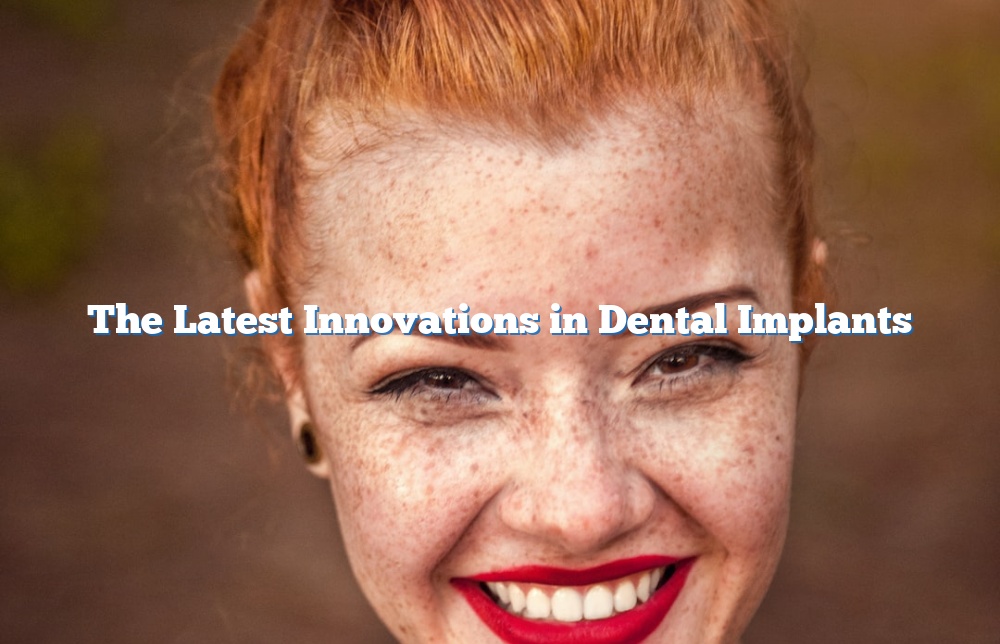 The Latest Innovations in Dental Implants
