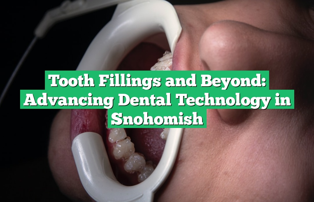 Tooth Fillings and Beyond: Advancing Dental Technology in Snohomish