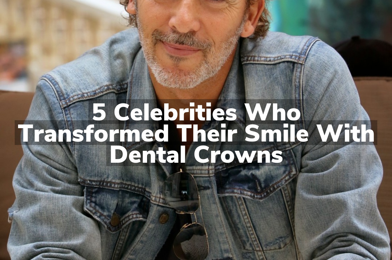 5 Celebrities Who Transformed Their Smile with Dental Crowns