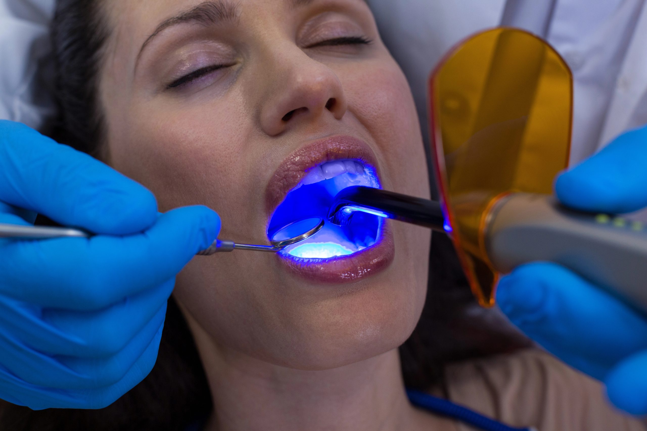 Discover the Benefits of Laser Dentistry Over Traditional Dental Methods in Snohomish WA: Essential Insights for Patients
